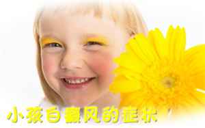 贵州有治疗白癜风的吗